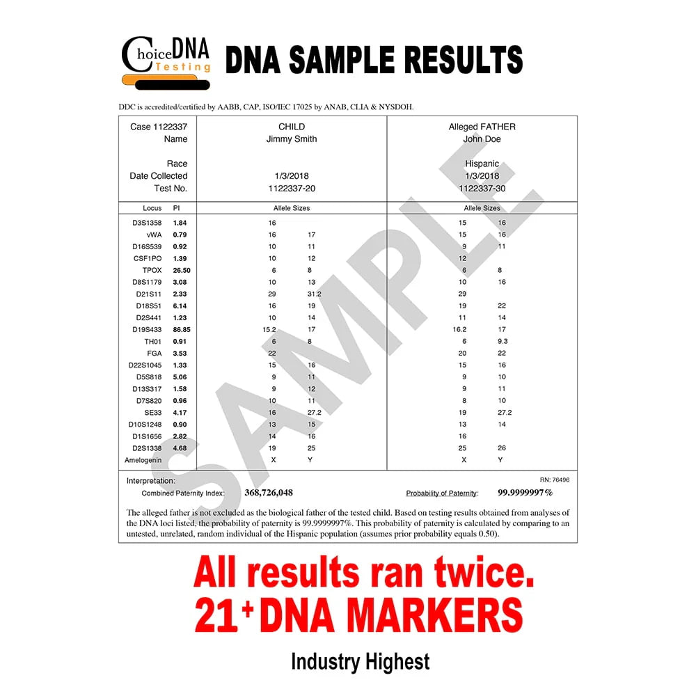 Home Paternity DNA Test Kit E392